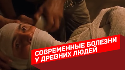 Современные болезни у древних людей